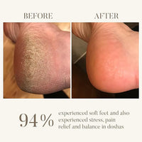 Ohria Ayurveda Amrit Ras Foot Balm | Relaxing, Softening, & Healing Foot Care | Hydrates & Softens Cracked Heels | Infused with Sesame, Almond, Cow’s Ghee & Essential Oils for Relaxation | All Skin Types| For Men & Women- 25g