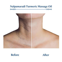 Blue Nectar Nalpamaradi Thailam Skin Brightening Treatment Oil | Plant Based Body Oil and Face Oil for Glowing Skin Infused with Turmeric, Amla and Manjistha (16herbs, 200ml)