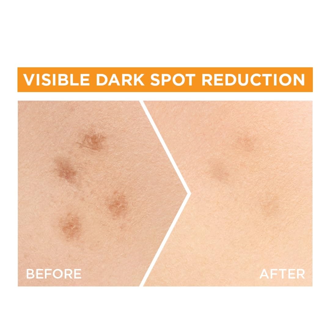 Garnier Skin Naturals, Face Serum, Brightening and Anti-Dark Spots, Bright Complete Vitamin C Booster, 15 ml