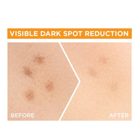 Garnier Skin Naturals, Face Serum, Brightening and Anti-Dark Spots, Bright Complete Vitamin C Booster, 15 ml