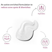 BE SOULFULL Spot Corrector Serum with 10% Niacinamide, 1% Zinc PCA for Normal to Oily Skin- Serum for Clear and Spotless Skin- Refine Skin Tone and Texture- checks Discoloration and Minimize Large Pores- 30ML