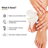 Fixderma 5% Lactic Acid, 15% Urea, 3% Glycerine Fidelia Foot Cream For Dry & Cracked Feet, Moisturizes and Soothes Feet, Heel Repair Paraben & Sulphate Free, All Skin Types 75gm