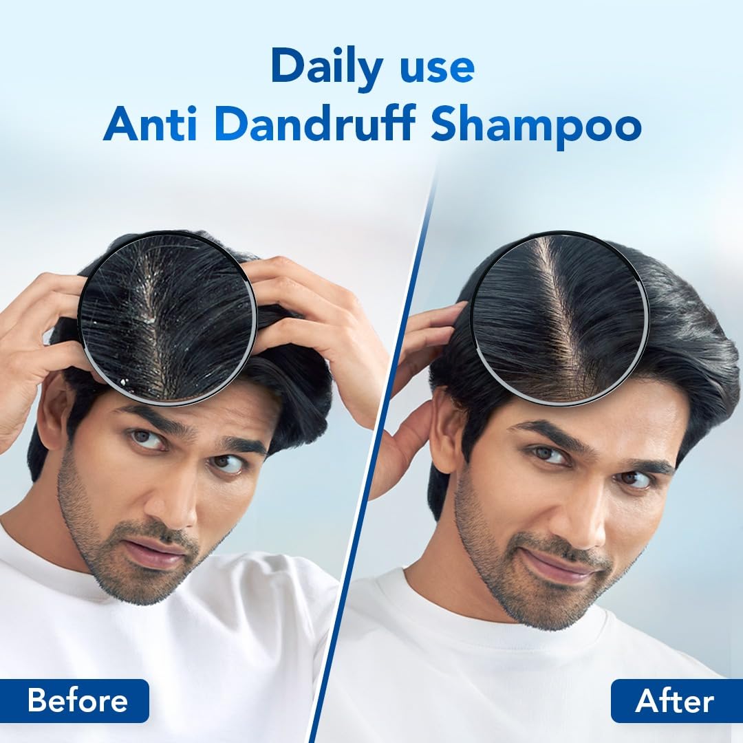 Scalpe Pro Daily Anti-Dandruff Shampoo | Removes Dandruff From Source | Helps With Itching, Irritation & Redness Accompanying Dandruff | Climbazole & Zpto Formulation | For Women & Men | 100Ml