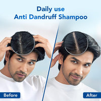 Scalpe Pro Daily Anti-Dandruff Shampoo | Removes Dandruff From Source | Helps With Itching, Irritation & Redness Accompanying Dandruff | Climbazole & Zpto Formulation | For Women & Men | 100Ml