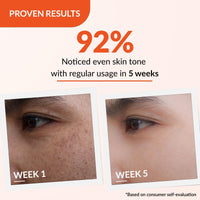 Fixderma Tranexamic Acid + 2% Kojic Acid + 1% Arbutin SKARFIX -TX Face Cream | Pigmentation Removal Cream | Kojic Acid Cream | Uneven Skin Tone - 15 gm (Pack of 1)