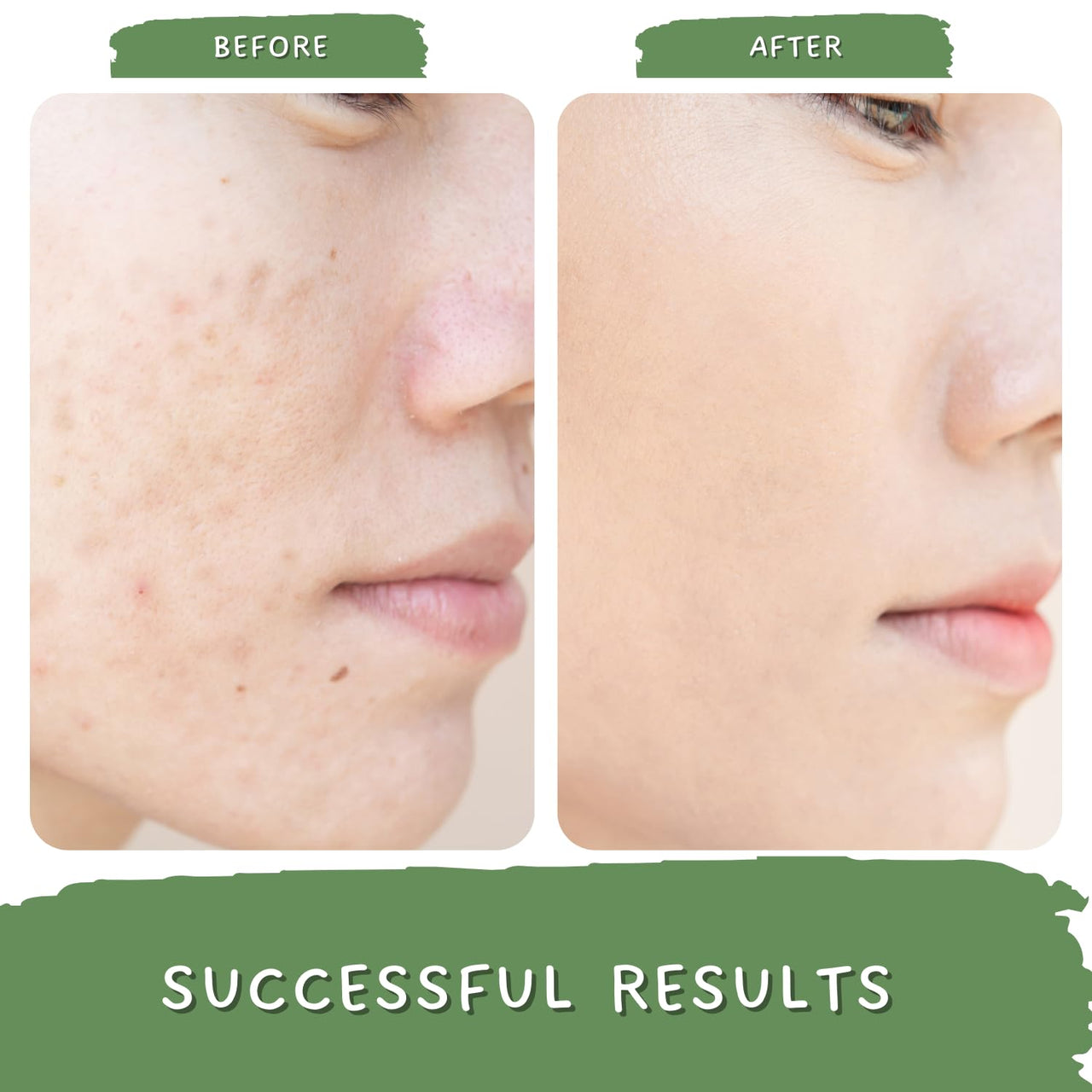 Mystiq Living Pigmentation Cream With Alpha Arbutin, Kojic Acid, Retinol & Niacinamide | Green Coffee Blemish Clear Cream for Dark Spots on Face - 50GM | Men & Women