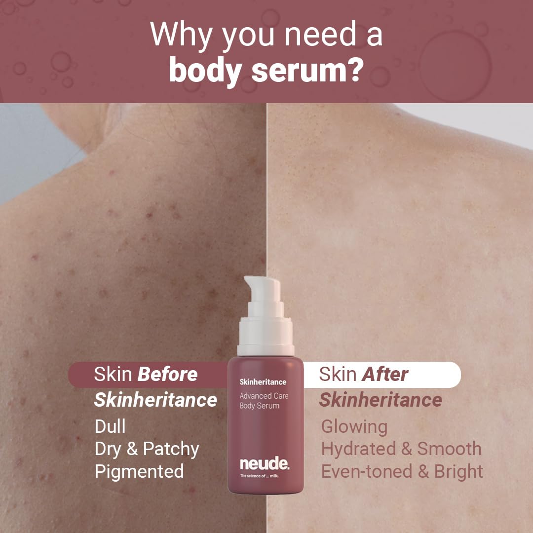 Neude SkinGenesis 30ml All in One Face Serum with 12% Actives – Lactic Acid, Niacinamide & Hyaluronic Acid; Reduces Dark Spots, Fine Lines, Protects Skin Barrier, For Men & Women, All Skin Types