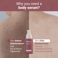 Neude SkinGenesis 30ml All in One Face Serum with 12% Actives – Lactic Acid, Niacinamide & Hyaluronic Acid; Reduces Dark Spots, Fine Lines, Protects Skin Barrier, For Men & Women, All Skin Types