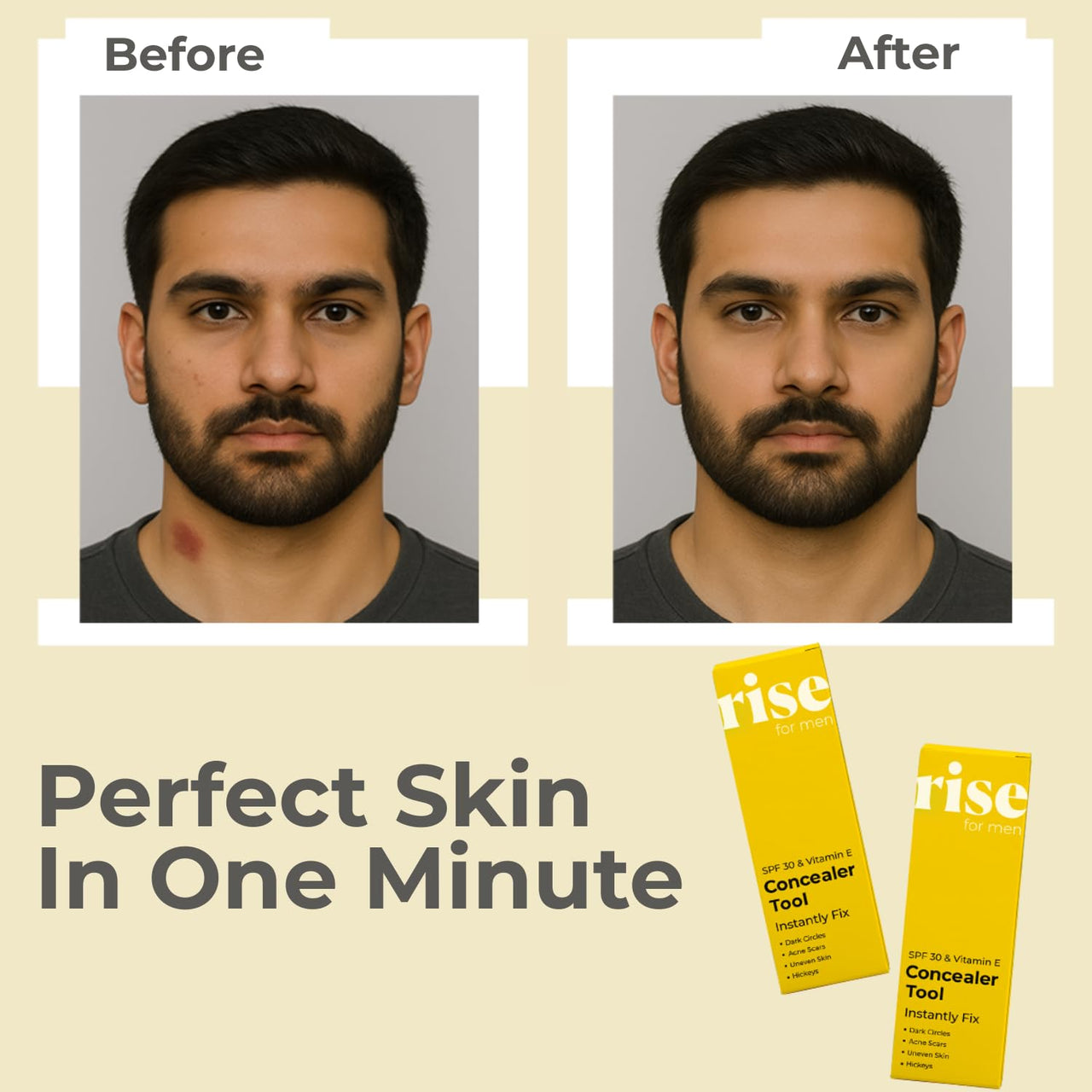 Rise for Men Concealer Tool | Covers Spots, Dark Circles, Acne Scars, & Hickeys Instantly | SPF 30 & Vitamin E | Available in 4 Shades (Dark)