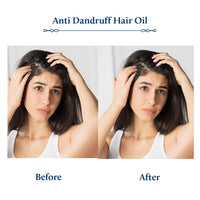 Blue Nectar Anti Dandruff Hair Oil with Neem & Tea Tree Hair Oil | Ayurvedic Non-Sticky Hair Oil for Dry Scalp and Dandruff | Plant Based Hair Oil for Men & Women (12 Herbs, 100ml)