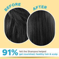 Coco Soul Shampoo with Coconut & Ayurveda | Paraben & Sulphate Free | 200ml