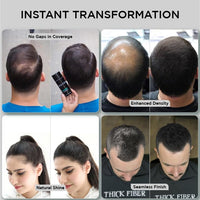 THICK FIBER - Fibers for Thinning Hair & Bald spots (BLACK, Pack of 3) - 25g Bottle - Conceals Hair Loss in Seconds For Women & Men