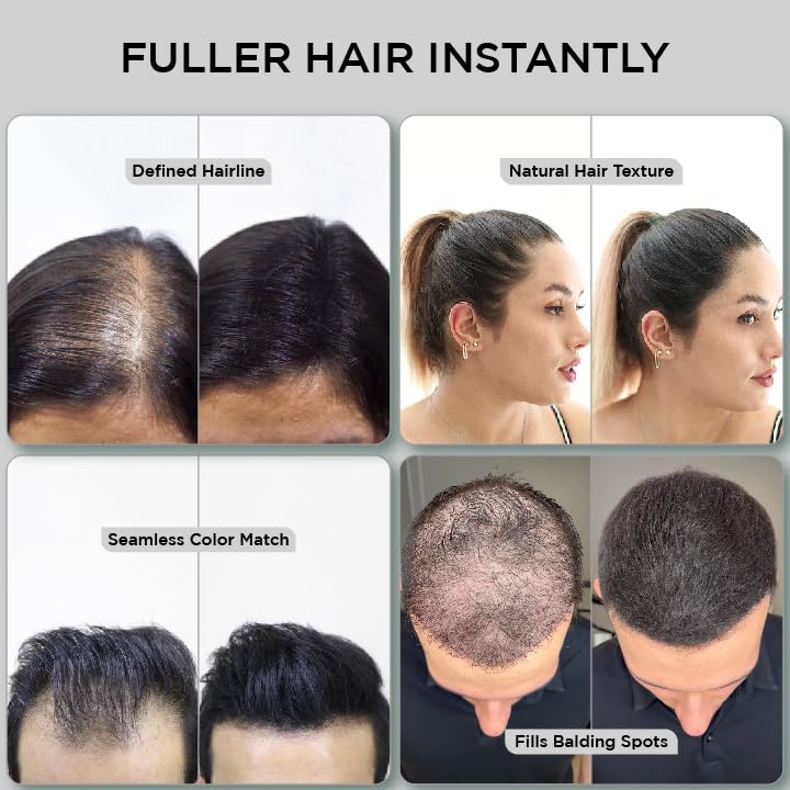 THICK FIBER - Fibers for Thinning Hair & Bald Spots (BLACK, Pack of 2) - 25g Bottle - Conceals Hair Loss in Seconds for Women & Men