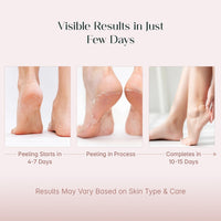SeoulSkin Glycolic Acid Foot Peeling Mask, 150000 PPM (1 Pair) Korean Peeling & Exfoliating | Deep Exfoliation with Glycolic Acid, Hydrates & Softens, Removes Dead Skin, Cruelty-Free, Vegan, Paraben-Free Foot Peel Off Mask for All Skin Types
