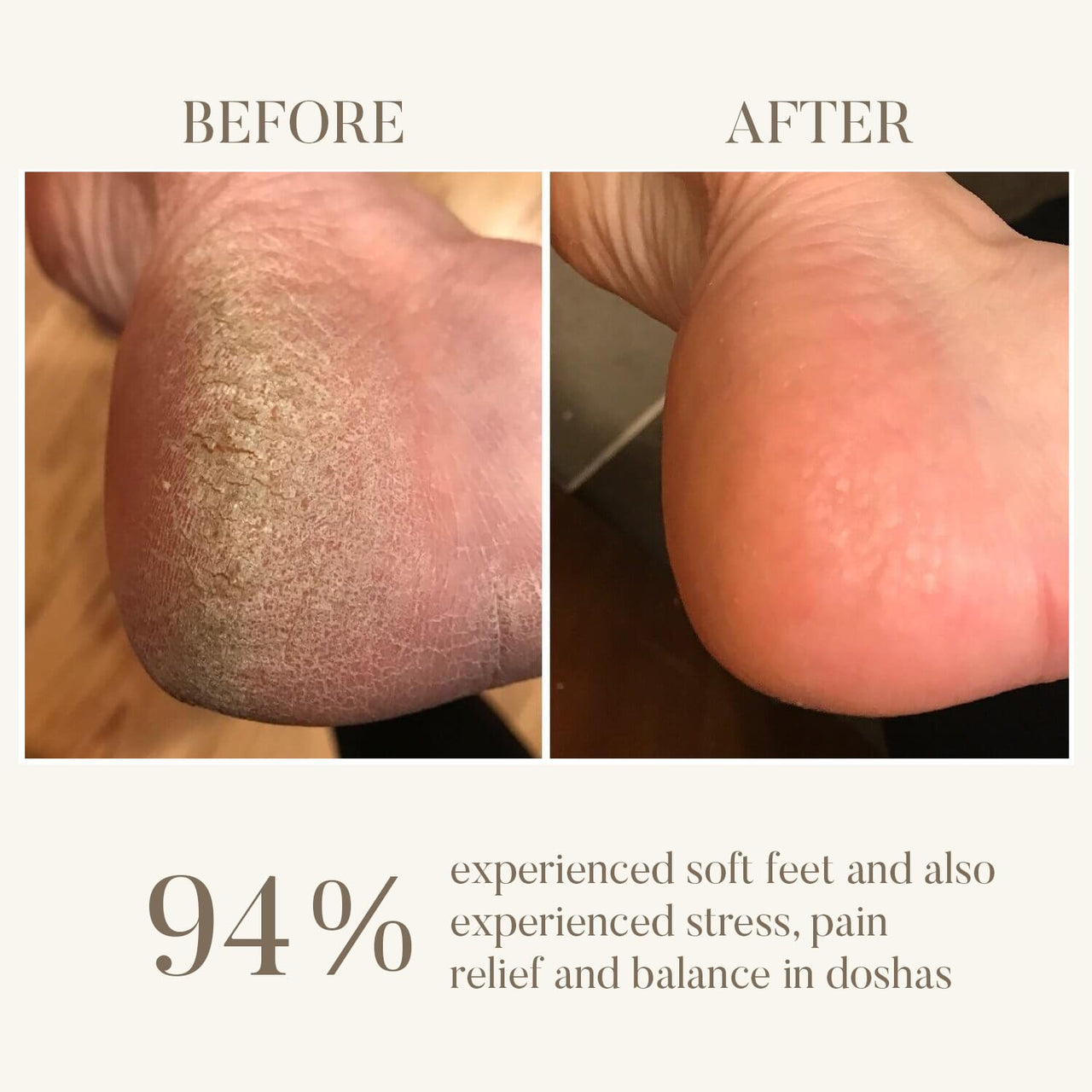 Ohria Ayurveda Amrit Ras Foot Balm Cream for Cracked Heals | Relaxing, Softening, & Healing Foot Care | Hydrates & Softens Cracked Heels | Infused with Sesame, Almond, Cow’s Ghee & Essential Oils for Relaxation | All Skin Types| For Men & Women- 100g