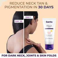 Sanfe Spotlite Body Kit | Lightens Overlooked Areas | Brightens Intimates | Non Toxic | 6 In 1 Glo Cream | Spotlite Serum