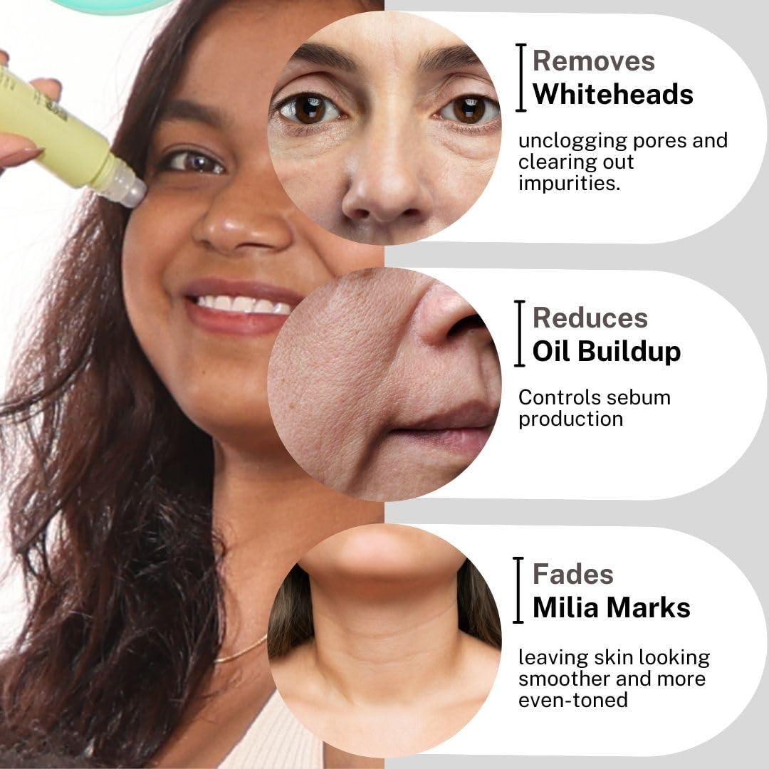HOUSE OF BEAUTY Milia Serum with Azelaic Acid, Niacinamide, Salicylic Acid for Whiteheads, Bumps and Milia, Face, Healthy Skin (15ml, Pack of 1)