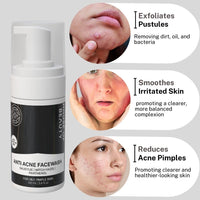 House of Beauty Anti Acne Foam Face Wash | Reduces Oil on Face, Deep Cleanses Pores, Reduces White Heads & Black Heads (100ml, Pack of 1)