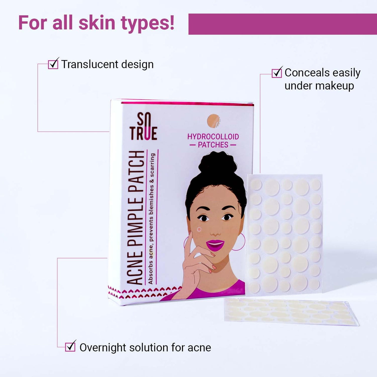 Sotrue Acne Pimple Patches For Face | For Active Surface Acne | Hydrocolloid Waterproof Patches | Absorbs Pimple Overnight, Reduces Excess Oil | Suits All Skin Types (36 Patches)