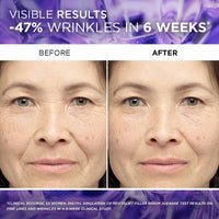 L'Oréal Paris, Face Serum, Hydrating & Plumping, Revitalift Filler 1.5% Pure Hyaluronic Acid, 30 ml
