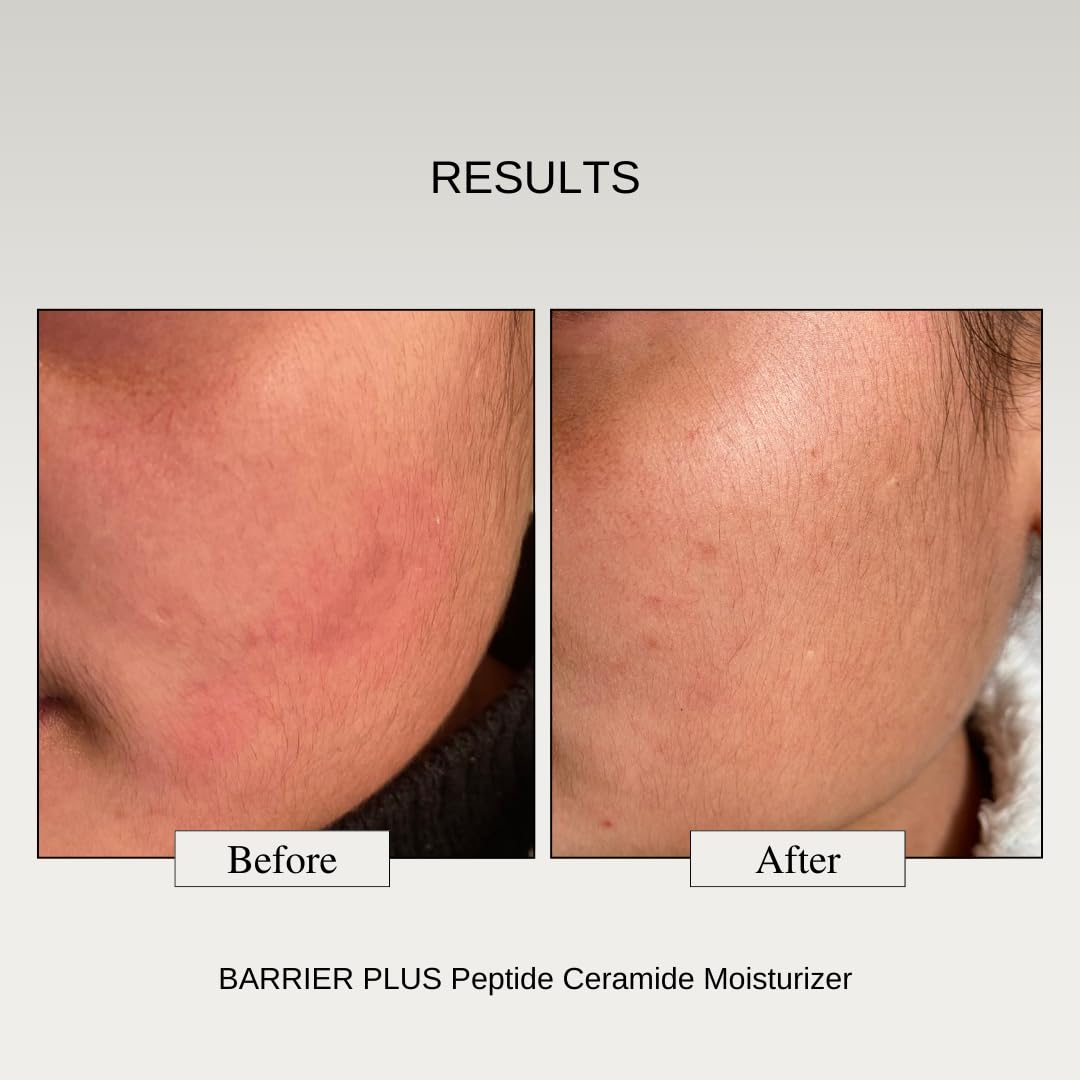 The Formularx Peptide Ceramide Moisturizer - Barrier Plus Nourishing Barrier Repair Moisturizer For Normal, Dry, Compromised, Sensitive skin 50 g