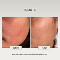 The Formularx Peptide Ceramide Moisturizer - Barrier Plus Nourishing Barrier Repair Moisturizer For Normal, Dry, Compromised, Sensitive skin 50 g