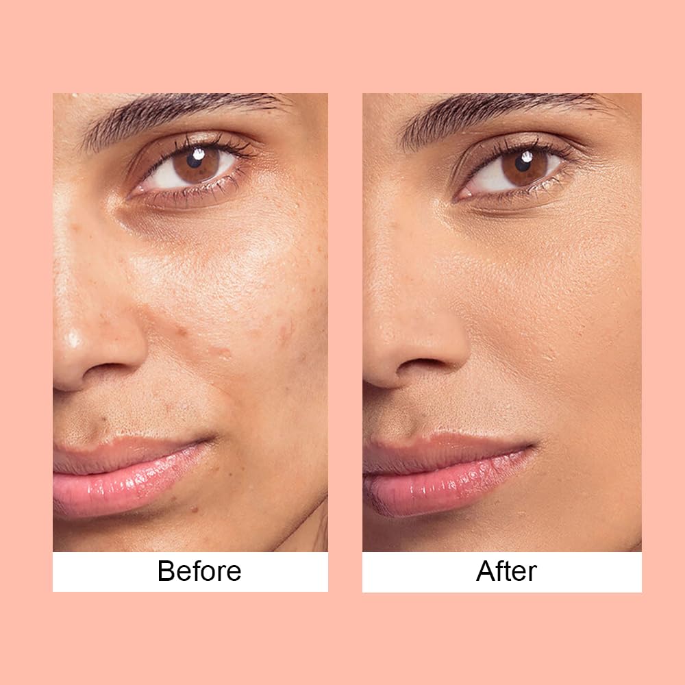 Lakyou Beauty Face Base Full Coverage Foundation | Waterproof | Long Lasting | Lightweight | SPF 20 | Shade-03(Natural Beige) | Pack Of 2