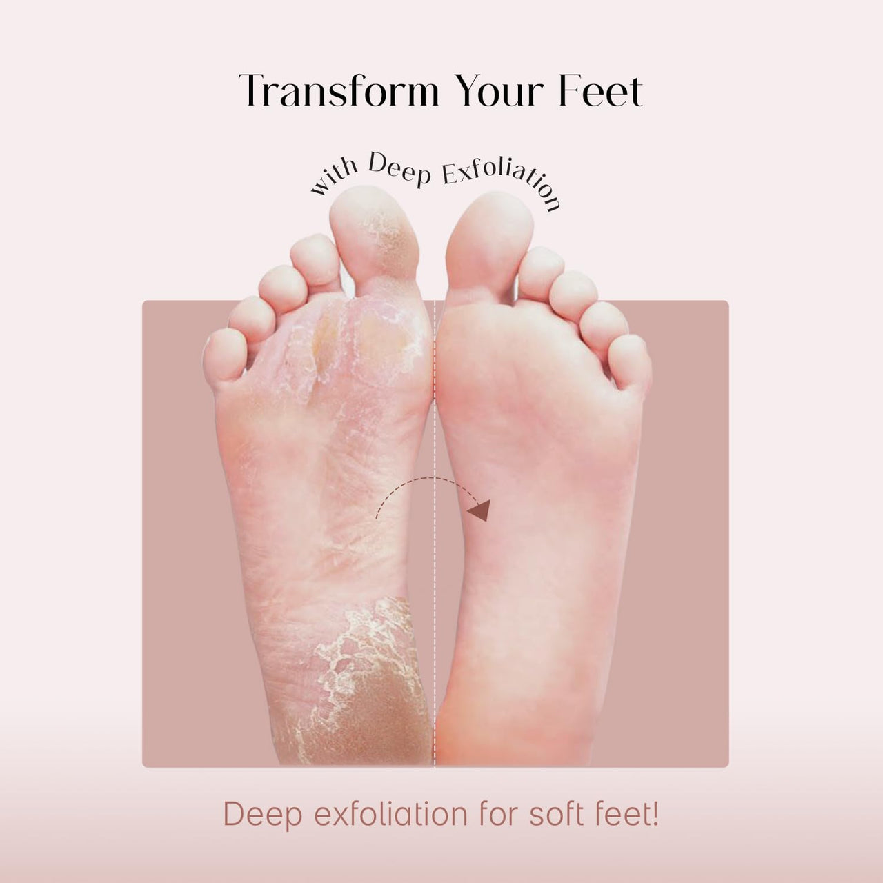 SeoulSkin Glycolic Acid Foot Peeling Mask, 150000 PPM (1 Pair) Korean Peeling & Exfoliating | Deep Exfoliation with Glycolic Acid, Hydrates & Softens, Removes Dead Skin, Cruelty-Free, Vegan, Paraben-Free Foot Peel Off Mask for All Skin Types