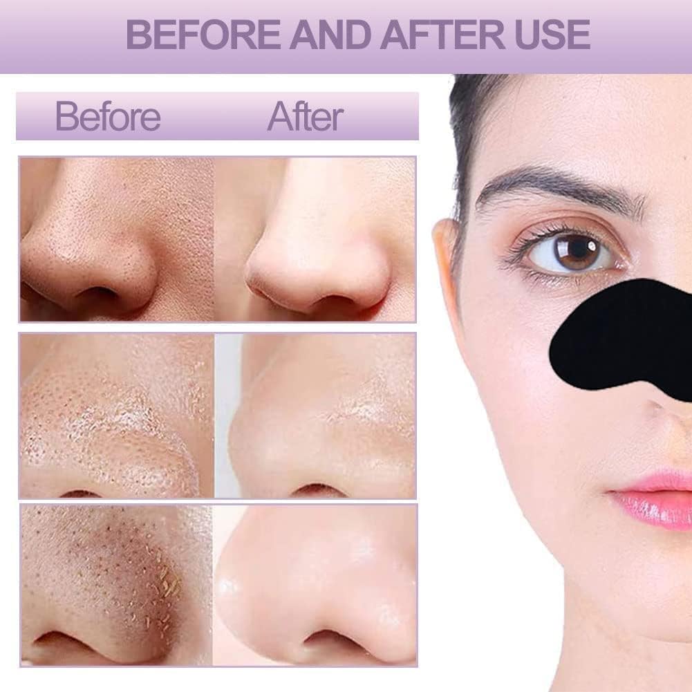 Luxenwell Deep Purifying Nose Strips for Women & Men | Enriched with Bamboo Charcoal | For Instant And Painless Blackheads And Whiteheads Removal (Pack of 20)