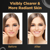 NATURALS Vitamin C Brightening Anti-Aging Glowing Skin Face Serum (multi, pack of 1)