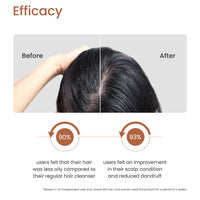 Earth Rhythm Scalp Exfoliating Shampoo Bar With 2% Salicylic Acid, Controls Excess Oil, Soothes Scalp, Reduces Dandruff, Paraben & Sulphate Free, Natural & Eco-Friendly - 80g (Cardboard)