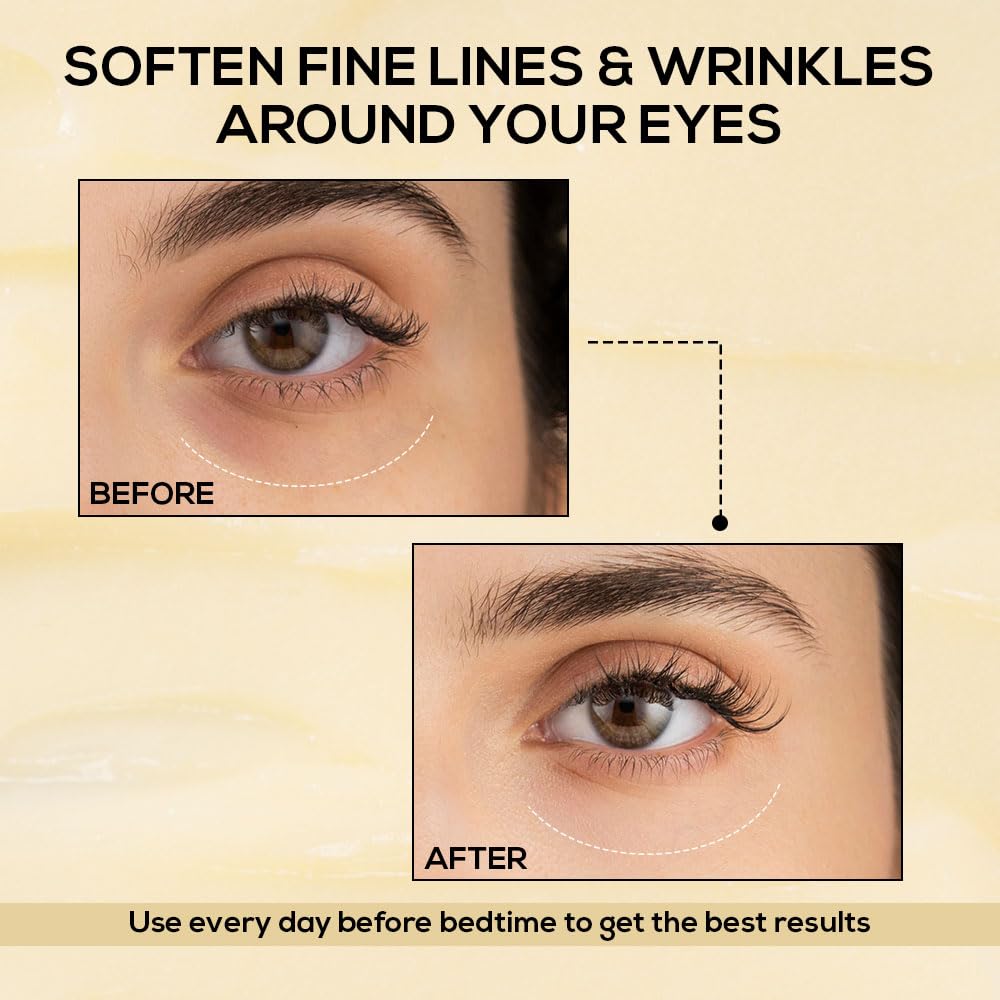 RENEE Retinol Eye Stick, Targets Wrinkles & Dark Circles, Revitalizes, Nourishes & Smooths Under-Eye Area, Infused with Retinol, Hyaluronic Acid, and Vitamin E, Travel Friendly, for All Skin Type, 2.9gm