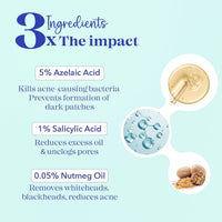 Blue Heaven Acne Clear Face Serum for Women with 5% Azelaic Acid +1% Salicylic Acid + 0.5% Nutmeg oil | Kills Acne Causing Bacteria| Acne Treatment & Pore Minimizing Face Serum, 20ml