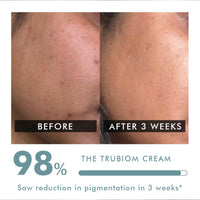 Conscious Chemist Kojic Acid Face Cream | 50g | Azelaic Acid Cream, Face Cream for Men & Women, Niacinamide Tranexamic Acid, Antipigmentation Cream, Reduce DarkSpot, All Skin Type - Trubiom (Pack 2)