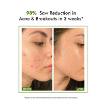 Conscious Chemist 2% Salicylic Acid Serum | 30ml | Face Serum for Acne, Blackheads & Opne Pores, Reduce Excess Oil & Bumpy Texture, BHA Based Exfoliant for Acne, Face Serum for Men & Women - Flashfix
