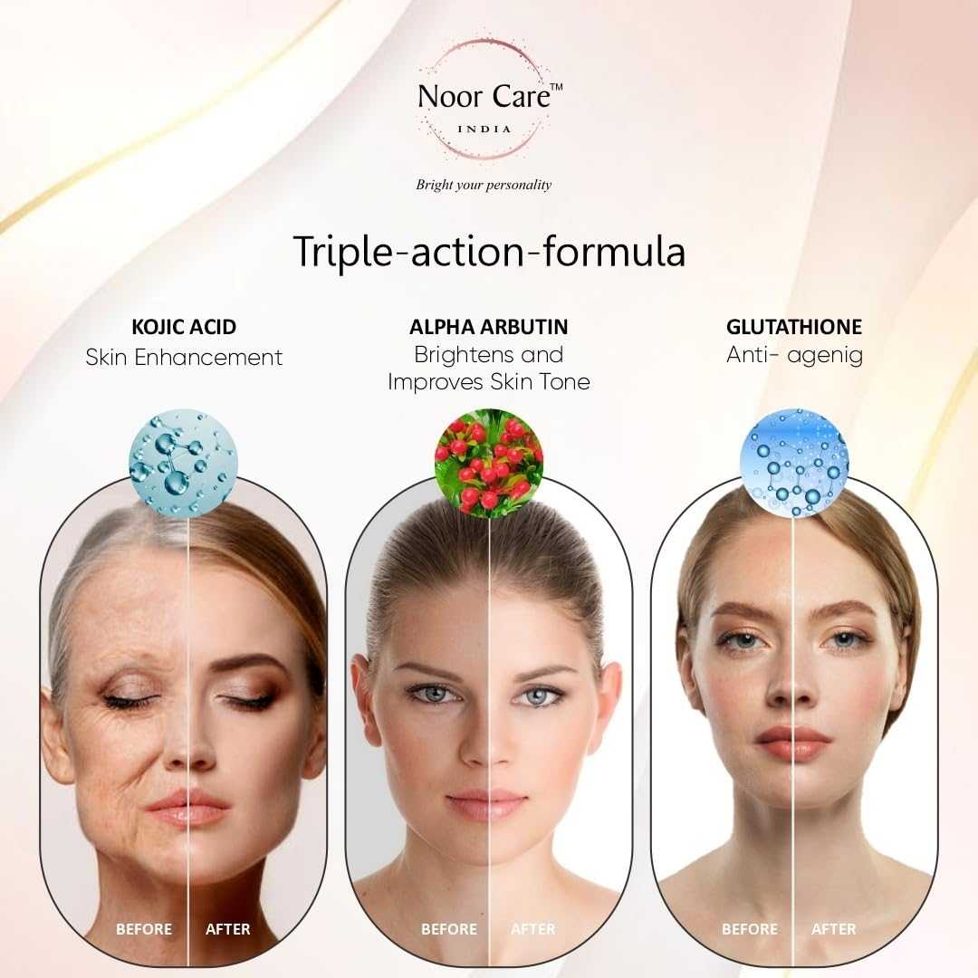 NOOR CARE INDIA Fairness Cream For Reducing Pimple Dark Spot, Dark Circle ultra Anti aging Cream Use For Men & Women, 15g