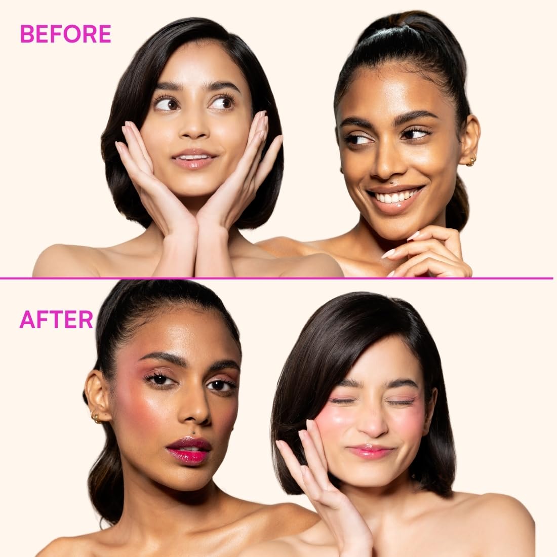 TYPE BEAUTY INC. Zit Quit Hydra Jelly Tints For Cheeks, Lips and Eyes | Lip Stain with Azelaic Acid for Acne | Long Lasting | Smudge-proof Lip Tint for Women & Girls - Bubble Gum (85) | 9g