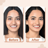 The Derma Co 2% Niacinamide Medium Coverage Liquid Foundation For All Skin Types With 1% Hyaluronic Acid & Spf 40 Pa+++ For 12 Hour Long Stay & Oil Control - 03 Natural, Pack Of 1