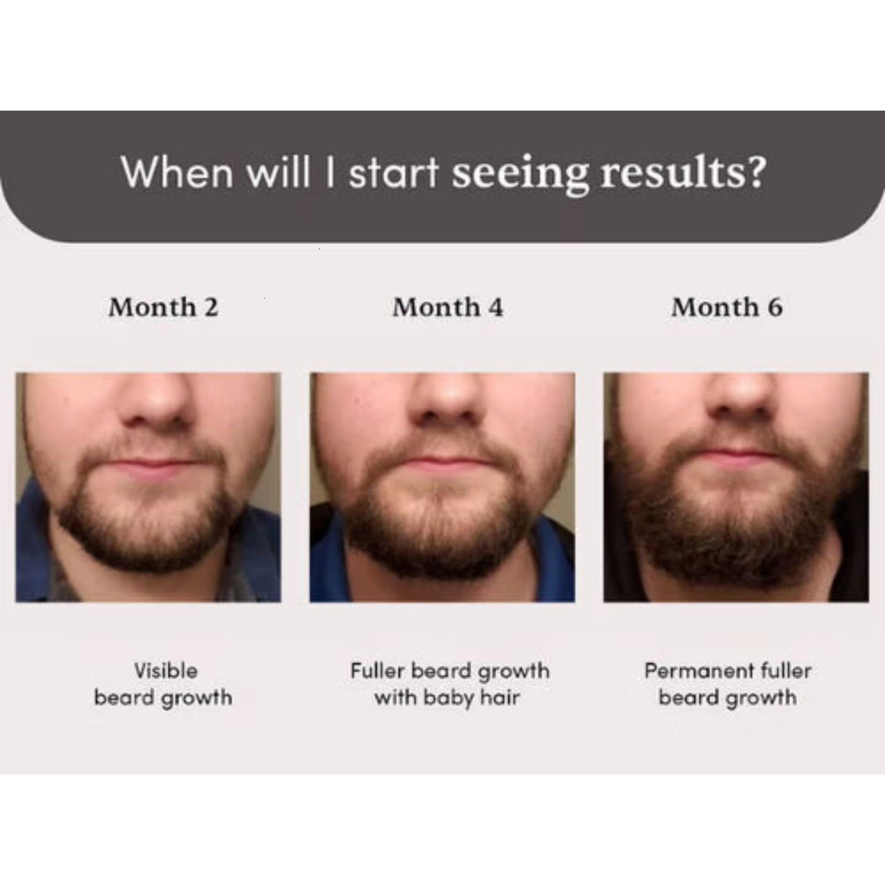 Man Matters Beardmax Growth Serum 30ml | 5% Minoxidil | Activates Beard Follicles | Solves Uneven & Patchy Beard | Alcohol Free