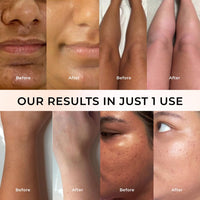 NICONI Tan Vanish Gluta-Kojic Skin Polish | Instant Tan Removal & Glowing Skin | Infused with Kojic Acid & Glutathione | Ideal for All Skin Types | Lightens Suntan | 180g