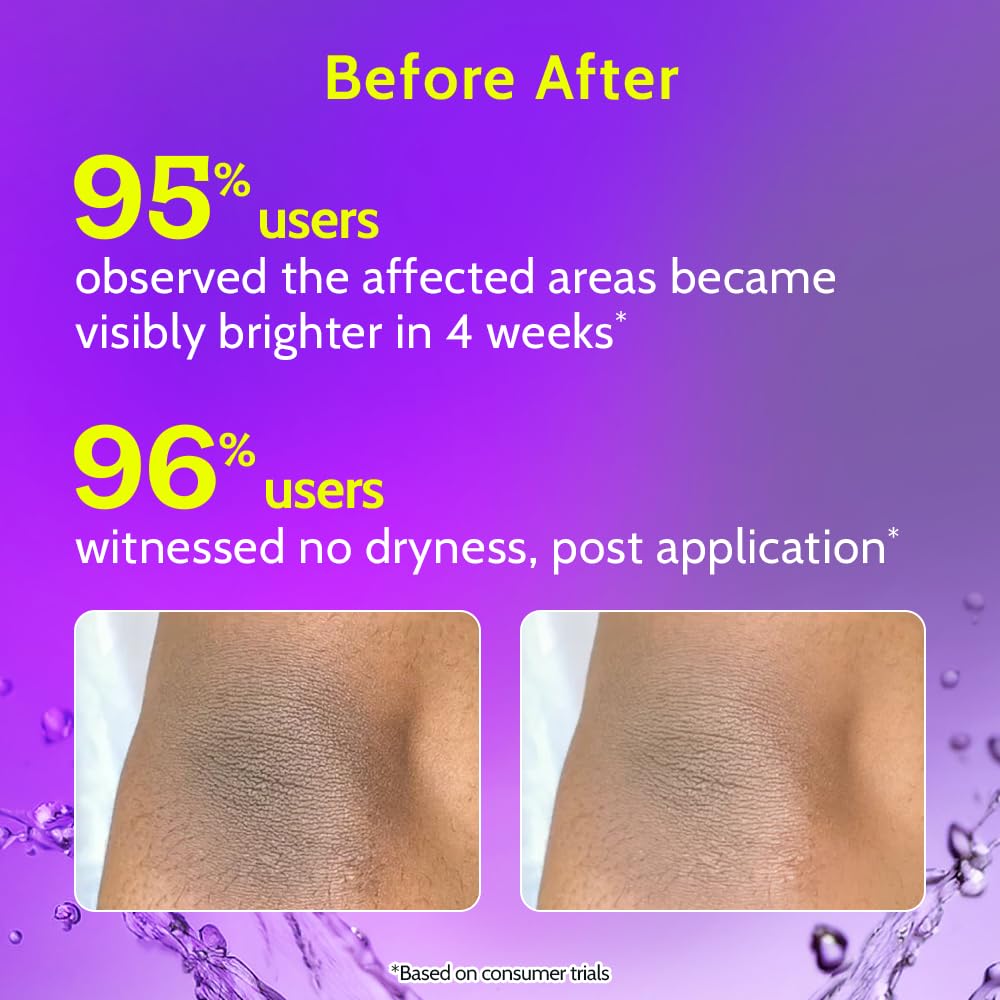 Chemist at Play Brightening Roll On For Neck, Knee & Elbow With 6% Vitamin C+ Hyaluronic Acid, AHAs, Niacinamide, & Ceramides | Helps Reduction in Pigmentation & Hydrates Dry Skin | 40ml