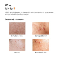 Minimalist Dehydrated Skin Moisturizer with 10% Vitamin B5 for Oily & Acne-Prone Skin | Oil-Free Hydration & Lightweight Gel Formula for Damaged Barrier Repair | Fast-Absorbing & Non-Sticky Lightweight Winter Cream For Women & Men | Fragrance-Free | 50 gr