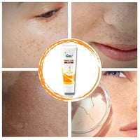 VCare Pimple Care Gel with Pimple Care Face Wash - 30g - 50g combo pack of 1