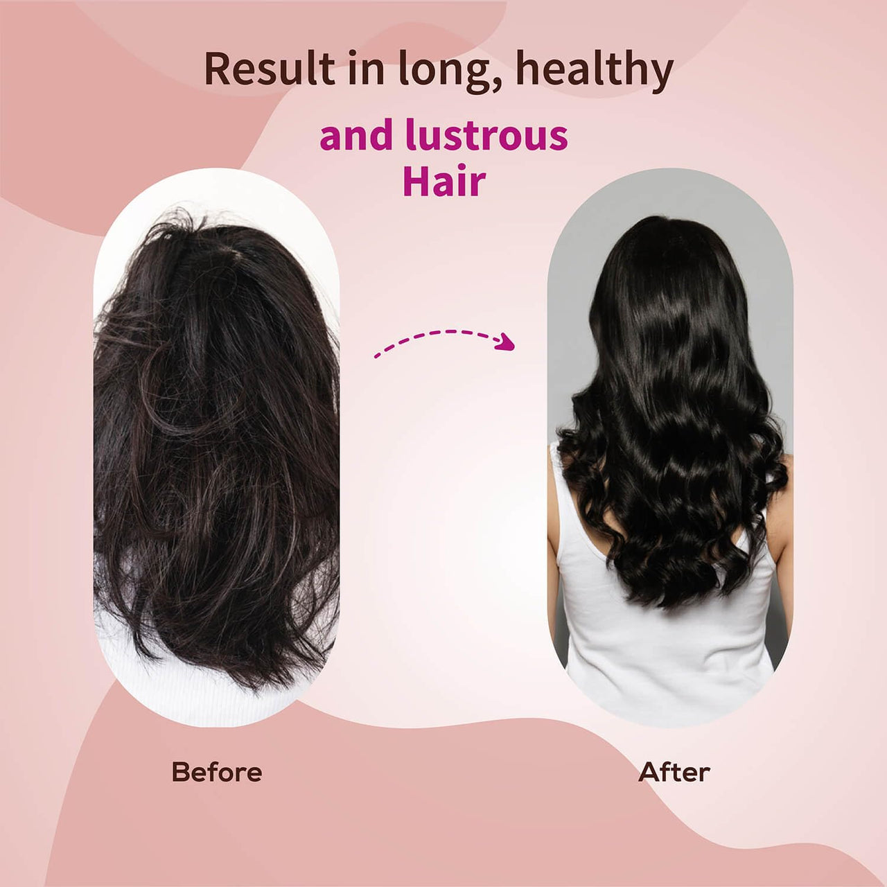Ayouthveda Anti-hairfall Shampoo | Salfate & Paraben Free | Prevents Dandruff & Itchi Scalp | Cleanse, Conditions & Purifies Hair & Scalp | Improve Hair Density & Texture (Pack Of 2-200ml each)