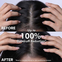 Naturali Shampoo For Dandruff | Tea Tree Oil For Hair | Sulphate Free | Dandruff Shampoo For Men | Paraben Free | 200 ml