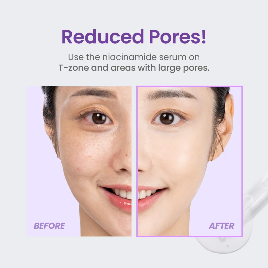 TIRTIR Niacinamide 20% Serum | High-Potency Vitamin B3 Face Serum for Brightening, Pore Minimizing & Oil Control | 30ml