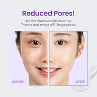 TIRTIR Niacinamide 20% Serum | High-Potency Vitamin B3 Face Serum for Brightening, Pore Minimizing & Oil Control | 30ml
