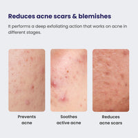 RE' EQUIL 0.5% Retinol Night Cream | Makes Skin Youthful & Smooth | Prevents Fine Lines & Wrinkles | Unisex | All Skin Types | 30G