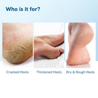 Be Bodywise 20% Urea Foot Cream Roll On 75ml | For Dry & Cracked Heels | With 2% Lactic Acid, Vitamin E & Olive Oil | Helps Moisturise and Repair Cracked Heels