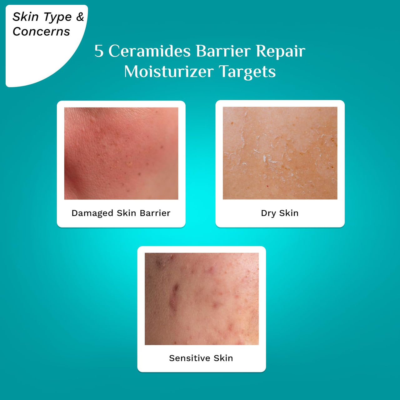 Pilgrim 5 Ceramides Moisturizer for Face 100g | Hyaluronic Acid for Intense Moisturizing & Skin Strengthening | Barrier Repair with Korean CICA | Lightweight & Non-Sticky | For All Skin Types I For Women and Men I